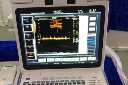 醫(yī)用超聲系列